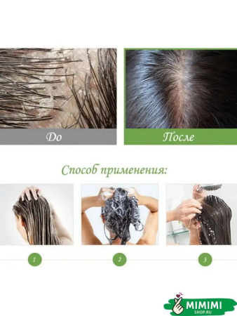 Шампунь от перхоти с яблочным уксусом Masil 5 Probiotics Apple Vinegar Shampoo 300мл